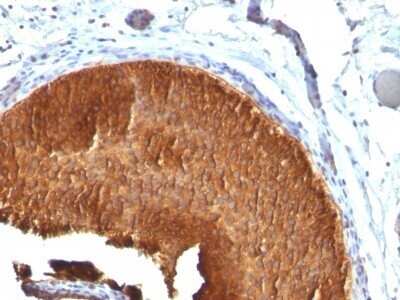Immunohistochemistry-Paraffin: Cytokeratin 19 Antibody (KRT19/799) - IHC-Prediluted [NBP2-48086]