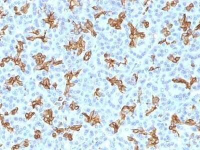 Immunohistochemistry-Paraffin: Cytokeratin 19 Antibody (KRT19/800) - Azide and BSA Free [NBP2-47946]