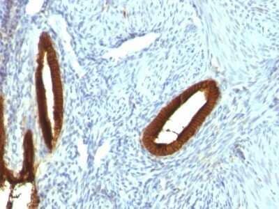 Immunohistochemistry-Paraffin: Cytokeratin 19 Antibody (KRT19/800) - IHC-Prediluted [NBP2-48095]