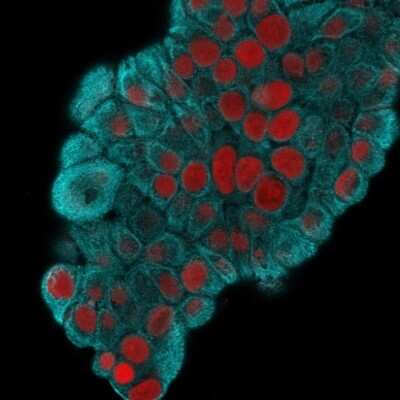 Immunocytochemistry/ Immunofluorescence: Cytokeratin 19 Antibody (KRT19/800) [NBP2-44827]