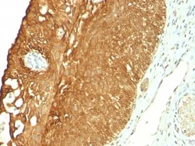 Immunohistochemistry-Paraffin: Cytokeratin 19 Antibody (KRT19/800) [NBP2-44827]
