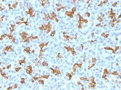 Immunohistochemistry-Paraffin: Cytokeratin 19 Antibody (KRT19/800) [NBP2-44827]