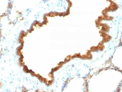 Immunohistochemistry-Paraffin: Cytokeratin 19 Antibody (KRT19/800) [NBP2-44827]