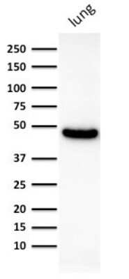 Western Blot: Cytokeratin 19 Antibody (KRT19/800) [NBP2-44827]