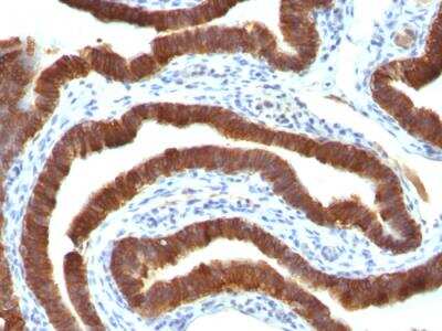 Immunohistochemistry-Paraffin: Cytokeratin 19 Antibody (Ks19.1) - Azide and BSA Free [NBP2-47947]