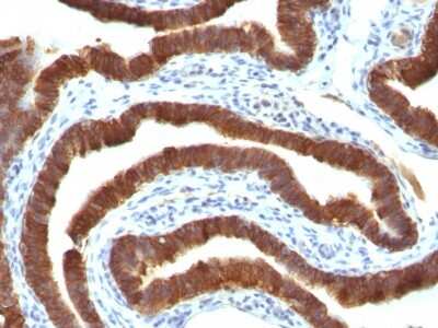 Immunohistochemistry-Paraffin: Cytokeratin 19 Antibody (Ks19.1) [NBP2-44828]