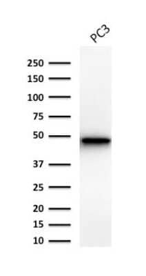 Western Blot: Cytokeratin 19 Antibody (Ks19.1) [NBP2-44828]