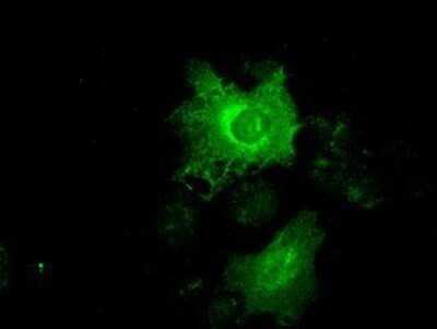 Immunocytochemistry/ Immunofluorescence: Cytokeratin 19 Antibody (OTI3F8) - Azide and BSA Free [NBP2-71092]