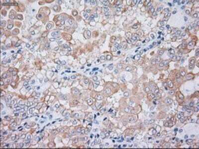 Immunohistochemistry: Cytokeratin 19 Antibody (OTI3F8) - Azide and BSA Free [NBP2-71092]