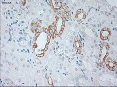 Immunohistochemistry: Cytokeratin 19 Antibody (OTI3F8) - Azide and BSA Free [NBP2-71092]