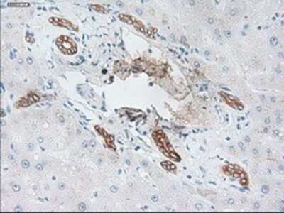 Immunohistochemistry: Cytokeratin 19 Antibody (OTI3F8) - Azide and BSA Free [NBP2-71092]