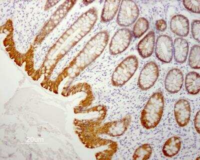 Immunohistochemistry-Paraffin: Cytokeratin 19 Antibody (RCK108) - BSA Free [NBP1-97712]