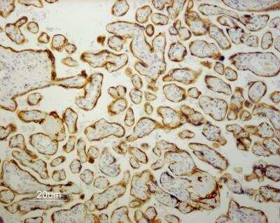 Immunohistochemistry-Paraffin: Cytokeratin 19 Antibody (RCK108) - BSA Free [NBP1-97712]