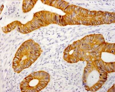 Immunohistochemistry-Paraffin: Cytokeratin 19 Antibody (RCK108) - BSA Free [NBP1-97712]
