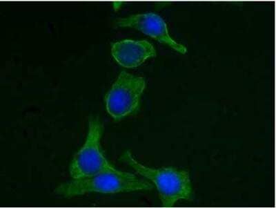 Immunocytochemistry/ Immunofluorescence: Cytokeratin 19 Antibody (SB39g) [NBP1-28570]