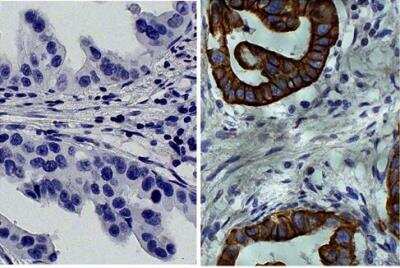 Immunohistochemistry-Paraffin: Cytokeratin 19 Antibody (SB39g) [NBP1-28570]