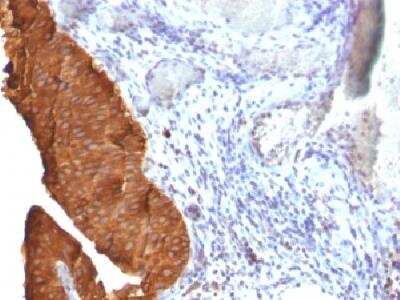 Immunohistochemistry-Paraffin: Cytokeratin 19 Antibody (SPM561) [NBP2-34379]