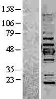 Western Blot: Cytokeratin 19 Overexpression Lysate [NBL1-12387]