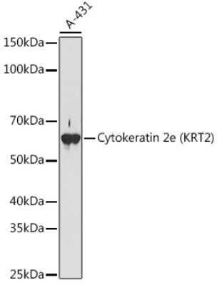 Western Blot: Cytokeratin 2 Antibody (9T3Q2) [NBP3-16139]