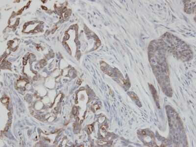 Immunohistochemistry-Paraffin: Cytokeratin 2 Antibody [NBP1-31423]