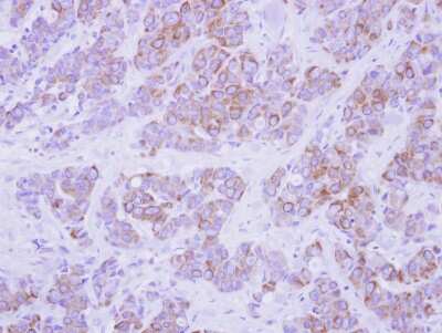 Immunohistochemistry-Paraffin: Cytokeratin 2 Antibody [NBP2-16091]