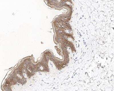 Immunohistochemistry-Paraffin: Cytokeratin 2 Antibody [NBP3-12790]