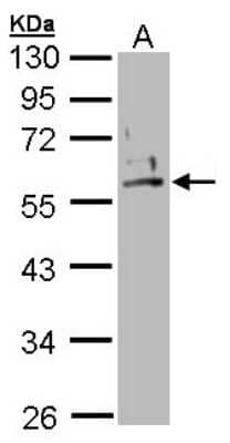 Western Blot: Cytokeratin 2 Antibody [NBP1-31423]