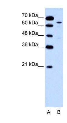 Western Blot: Cytokeratin 2 Antibody [NBP1-55126]