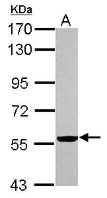 Western Blot: Cytokeratin 2 Antibody [NBP2-16091]