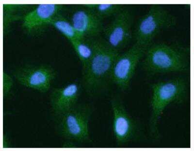 Immunocytochemistry/ Immunofluorescence: Cytokeratin 20 Antibody (10D8) - BSA Free [NBP2-42616]