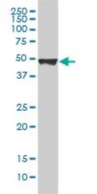 Western Blot: Cytokeratin 20 Antibody (2G3-1C8) [H00054474-M01]