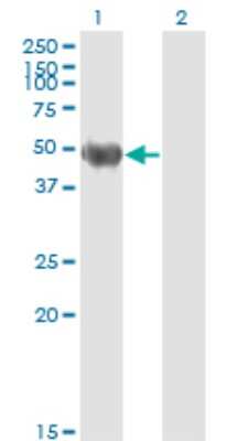 Western Blot: Cytokeratin 20 Antibody (2G3-1C8) [H00054474-M01]
