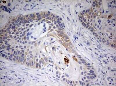 Immunohistochemistry: Cytokeratin 20 Antibody (OTI3G1) [NBP2-45556]