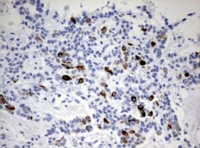 Immunohistochemistry: Cytokeratin 20 Antibody (OTI3G1) [NBP2-45556]