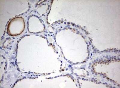 Immunohistochemistry: Cytokeratin 20 Antibody (OTI3G1) [NBP2-45556]