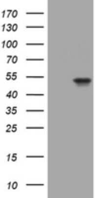 Western Blot: Cytokeratin 20 Antibody (OTI3G1) [NBP2-45556]