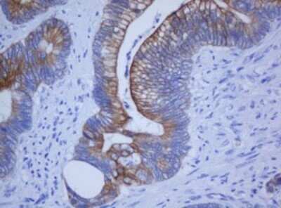 Immunohistochemistry: Cytokeratin 20 Antibody (OTI4A2) [NBP2-45782]