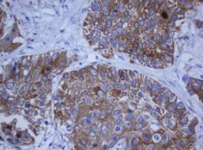 Immunohistochemistry: Cytokeratin 20 Antibody (OTI4A2) [NBP2-45782]