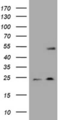 Western Blot: Cytokeratin 20 Antibody (OTI4A2) [NBP2-45782]