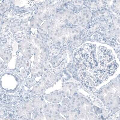 Immunohistochemistry-Paraffin: Cytokeratin 20 Antibody (CL9390) [NBP2-88932]
