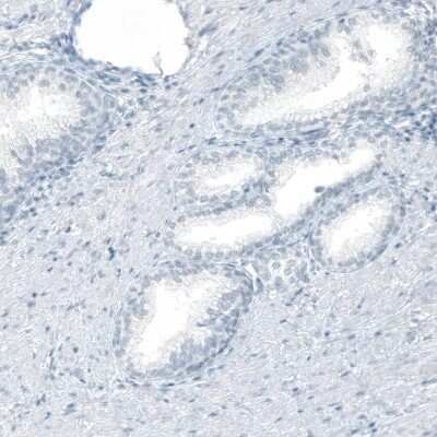 Immunohistochemistry-Paraffin: Cytokeratin 20 Antibody (CL9390) [NBP2-88932]