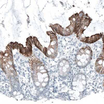 Immunohistochemistry-Paraffin: Cytokeratin 20 Antibody (CL9390) [NBP2-88932]