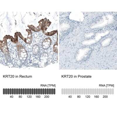Immunohistochemistry-Paraffin: Cytokeratin 20 Antibody (CL9390) [NBP2-88932]