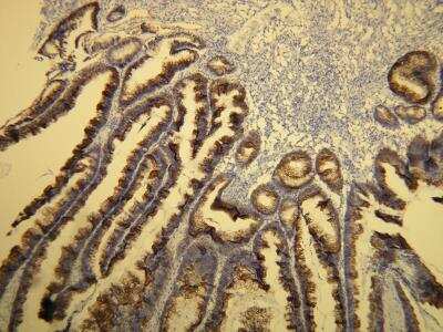 Immunohistochemistry-Paraffin: Cytokeratin 20 Antibody (E19-I) [NBP2-21840]