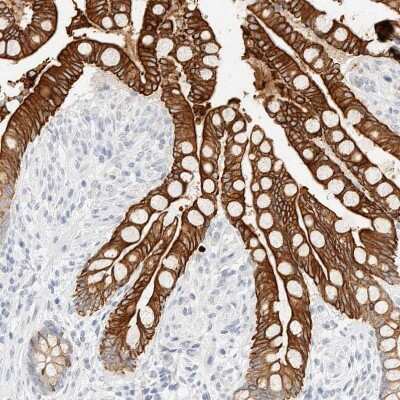 Immunohistochemistry-Paraffin: Cytokeratin 20 Antibody [NBP1-85598]