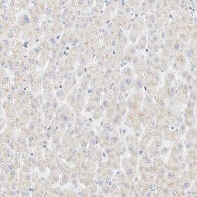 Immunohistochemistry-Paraffin: Cytokeratin 20 Antibody [NBP1-85598]