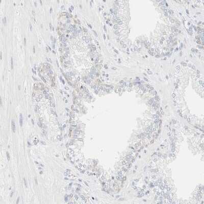 Immunohistochemistry-Paraffin: Cytokeratin 20 Antibody [NBP1-85598]
