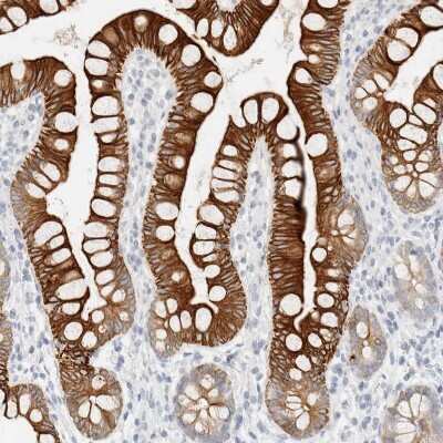 Immunohistochemistry-Paraffin: Cytokeratin 20 Antibody [NBP1-85598]