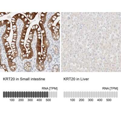 Immunohistochemistry-Paraffin: Cytokeratin 20 Antibody [NBP1-85598]