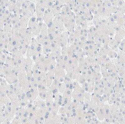 Immunohistochemistry-Paraffin: Cytokeratin 20 Antibody [NBP1-85599]